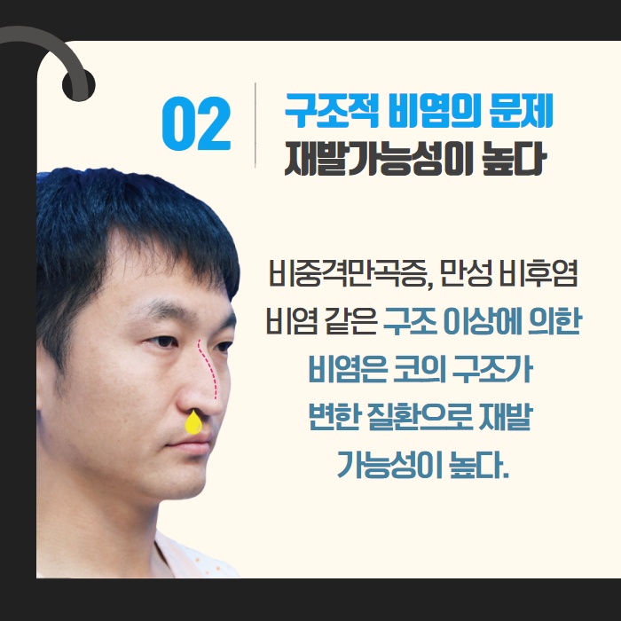 [수원 이비인후과] 콧물이 나는 이유 감기가 아닐 수도. (6/14)