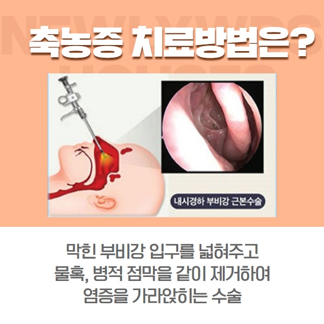 [수원이비인후과] 축농증(부비동염) 원인과 치료 방법! (8/15)