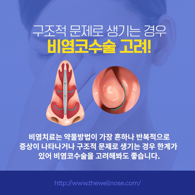 비중격만곡증치료와 코성형을 동시에, 원인과 치료 방법 (2/11)