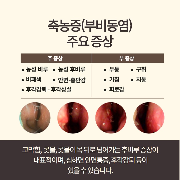 감기와 부비동염 (축농증)의 차이! 원인과 치료방법. (3/11)