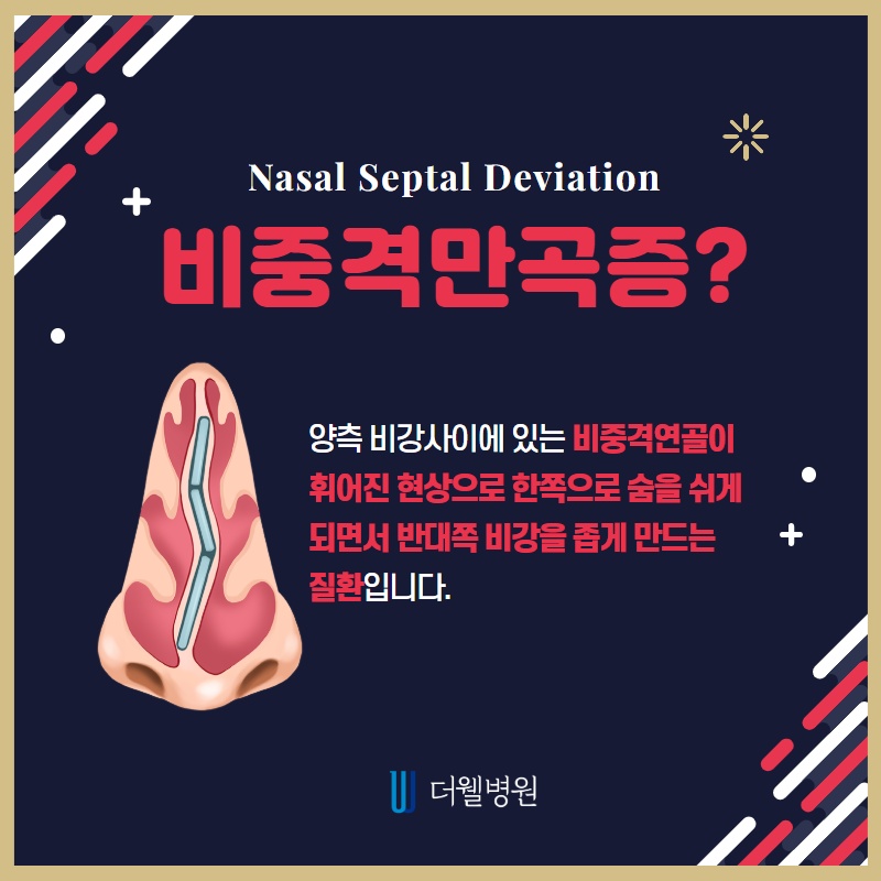 코막힘의 원인, 비중격 만곡증 (2/10)