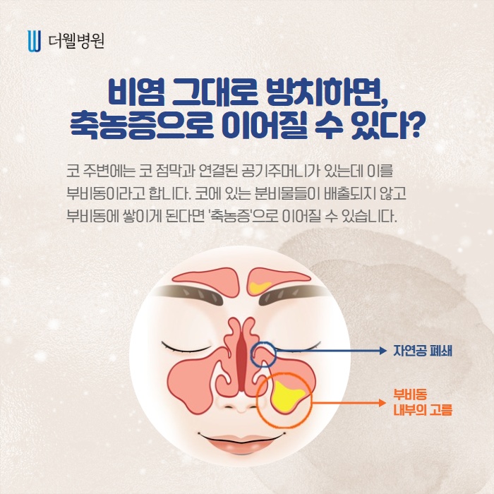 미세먼지로 힘든 코, 하루 한번 코세척 (3/10)