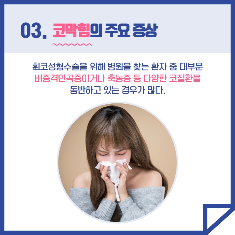 휘어진 코 성형 수술 (4/9)