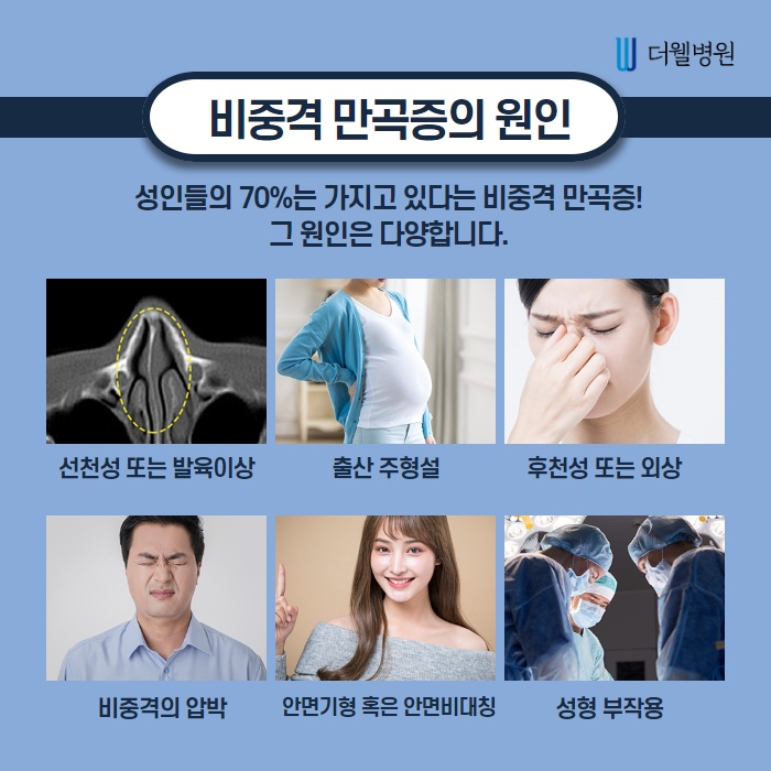 비중격만곡증, 수술로만 치료가 가능할까? (2/11)