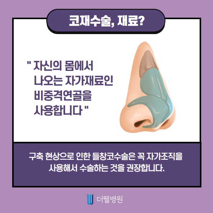 코 재수술 키포인트는? (4/10)