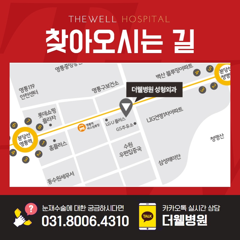 눈 재수술, 더 신중하게 결정하세요! (9/10)