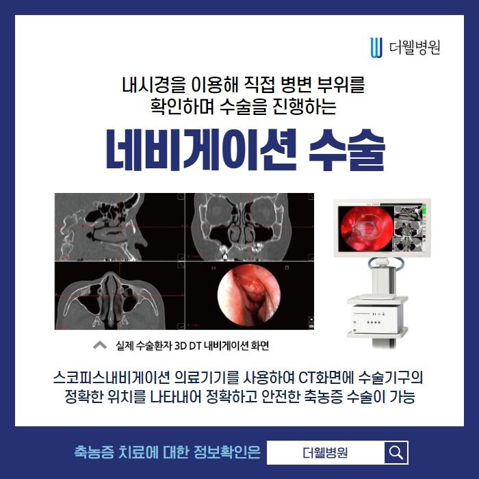 끈적이는 콧물 축농증, 어떻게 치료해야하나요? (5/11)