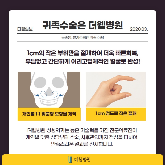 돌출입, 팔자주름엔 귀족수술!! (8/13)