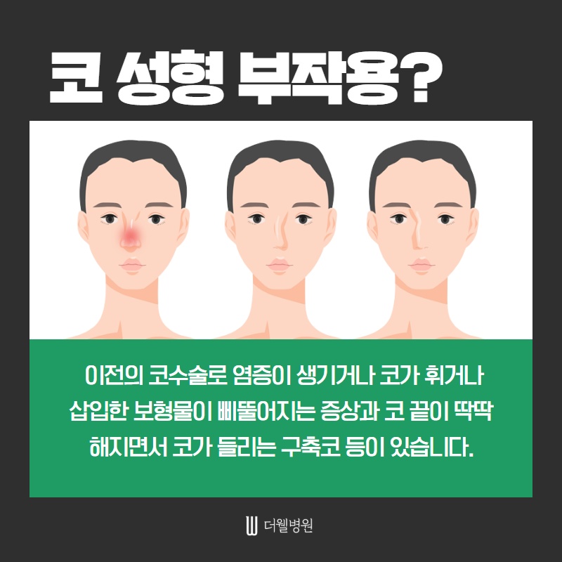 코 재수술 키포인트! (2/11)
