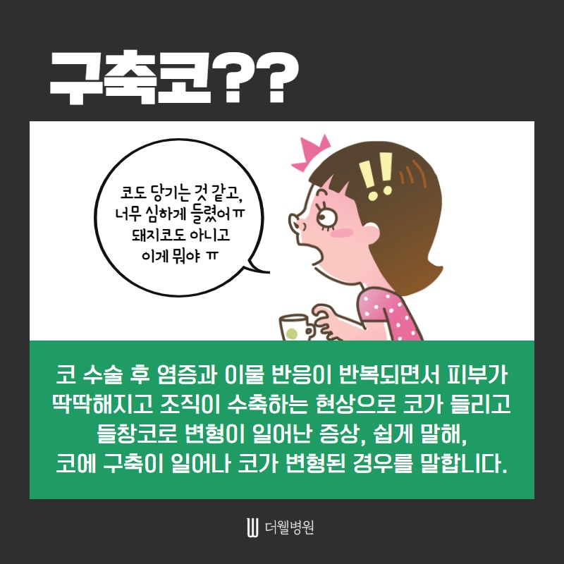 코 재수술 키포인트! (3/11)