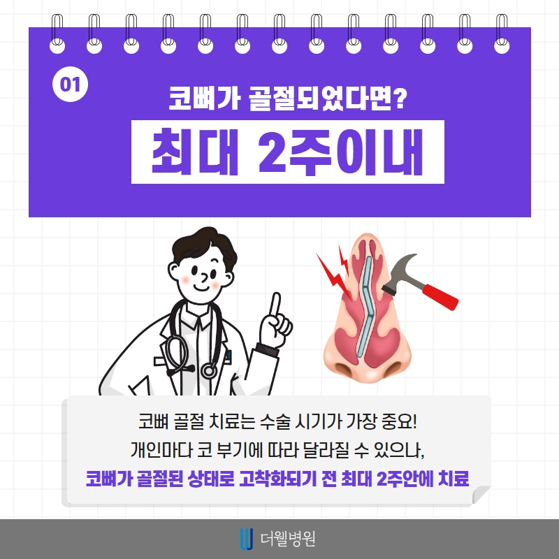 코 뼈 골절, 치료 시기가 중요합니다! (2/10)