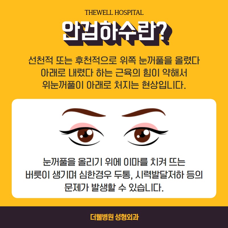 졸리고 처진 눈을 생기있게! (3/11)