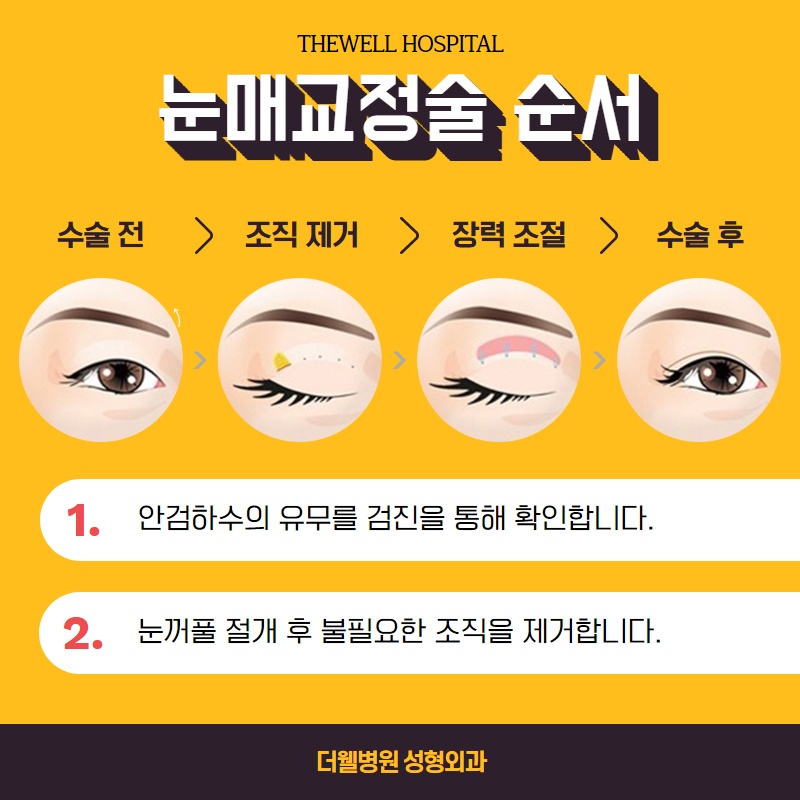 졸리고 처진 눈을 생기있게! (5/11)