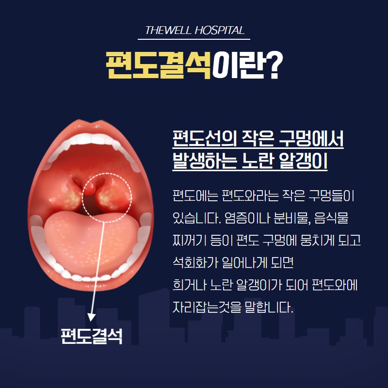 마스크 속 지독한 입냄새 제거하기! (9/12)