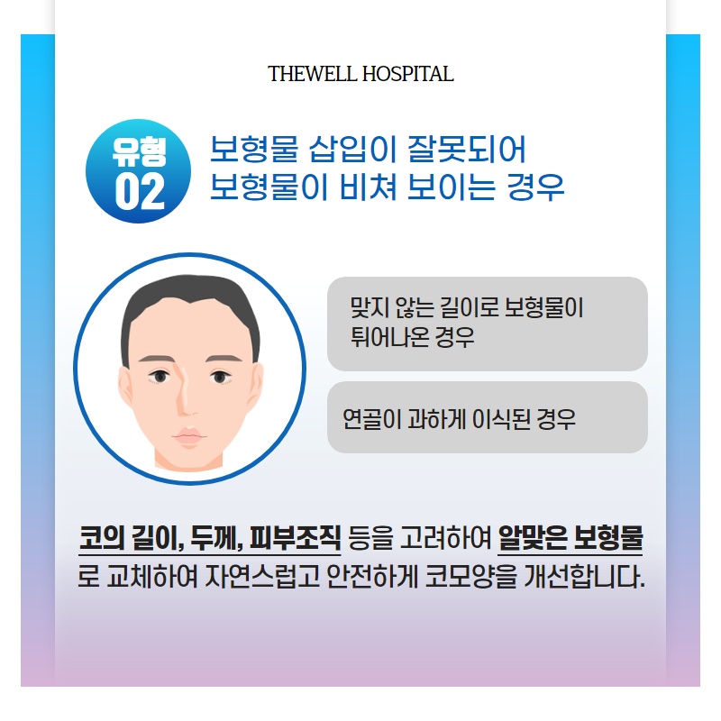 다양한 유형의 코 재수술, 더웰병원에서 하자! (4/10)