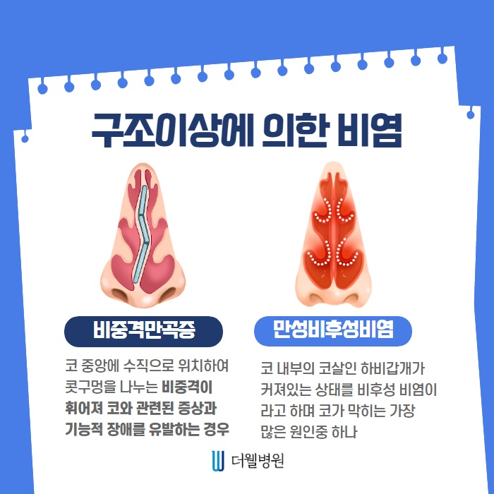 환절기 비염주의보! 즉시 치료해야합니다! (4/11)