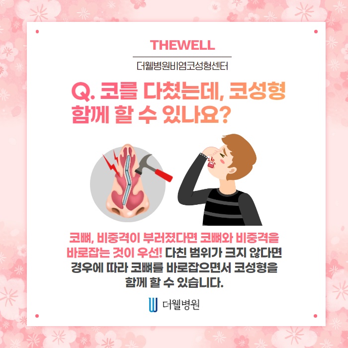 비염수술 코성형 Q&A! (3/10)