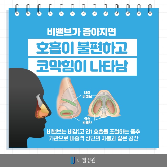 비밸브재건술은 왜 필요할까요? (2/11)