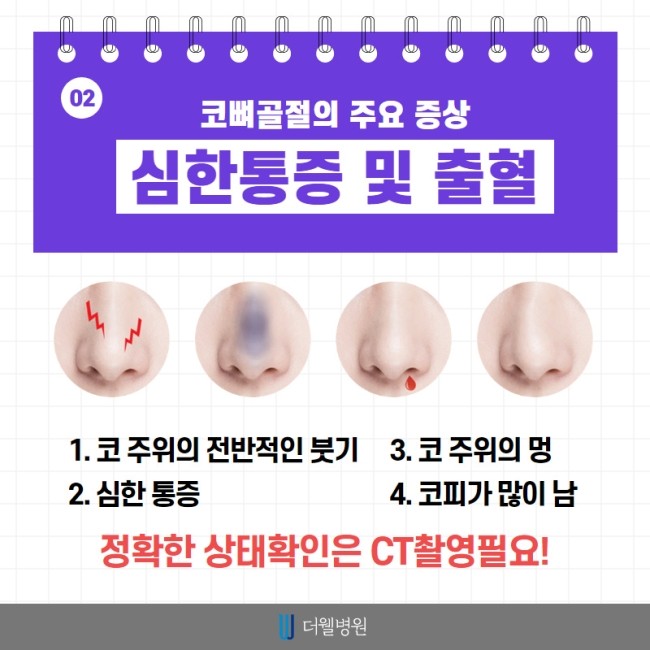 코 뼈 골절은 치료시기가 중요해요! (3/10)