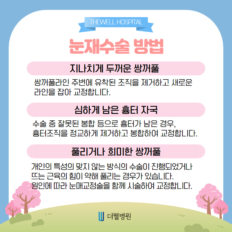 신중하게 결정하세요 "눈재수술"~ (4/10)