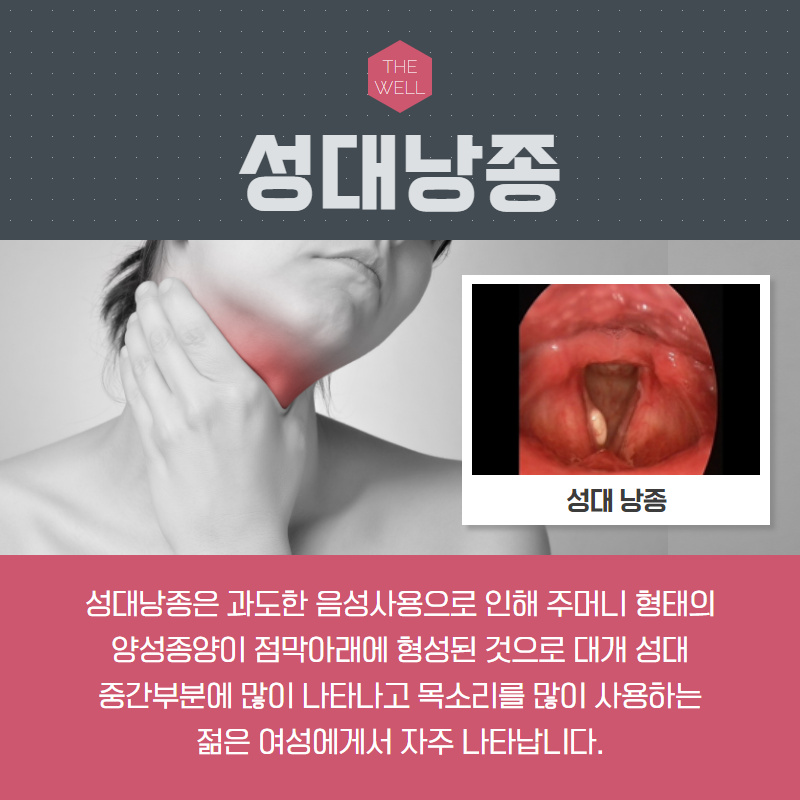 쉰 목소리, 목에 무언가 걸린 듯한 이물감이 느껴진다면?! (2/10)
