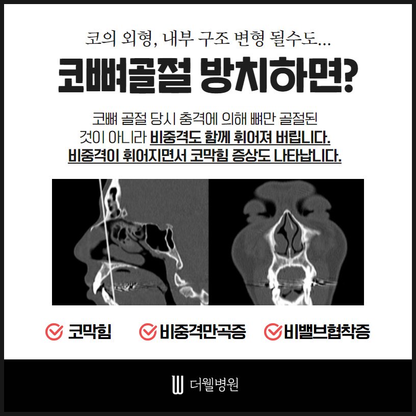 골든타임을 놓치면 후회한다! (4/10)