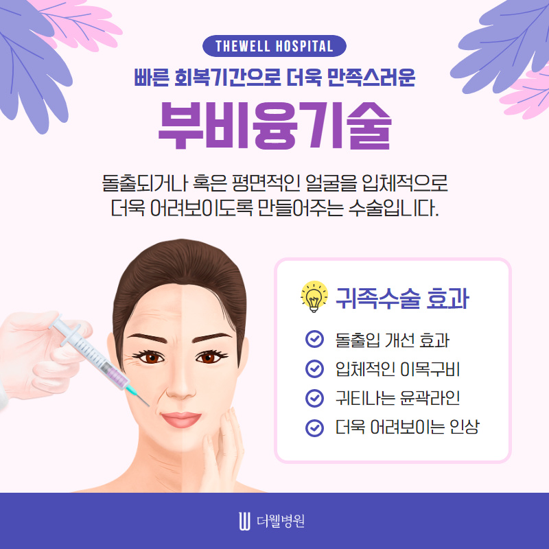 동안얼굴 원한다면 귀족수술 고고싱! (2/10)