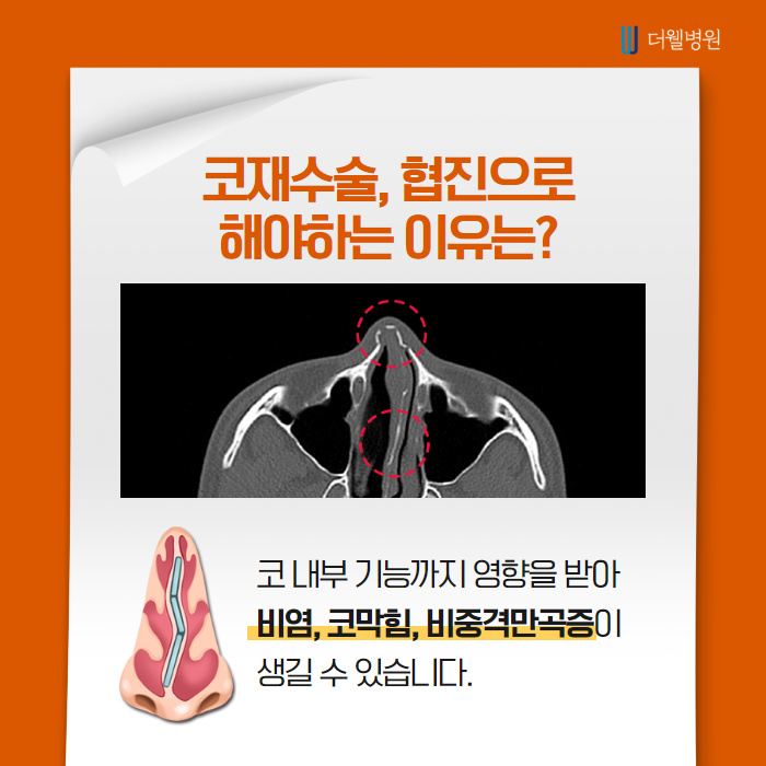 짧은 코 재수술에 대한 해답! (3/9)