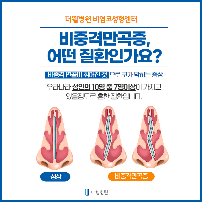비중격이 휘어지는 이유는?? (2/12)