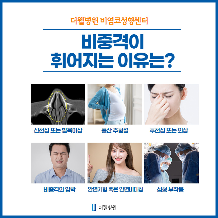 비중격이 휘어지는 이유는?? (3/12)