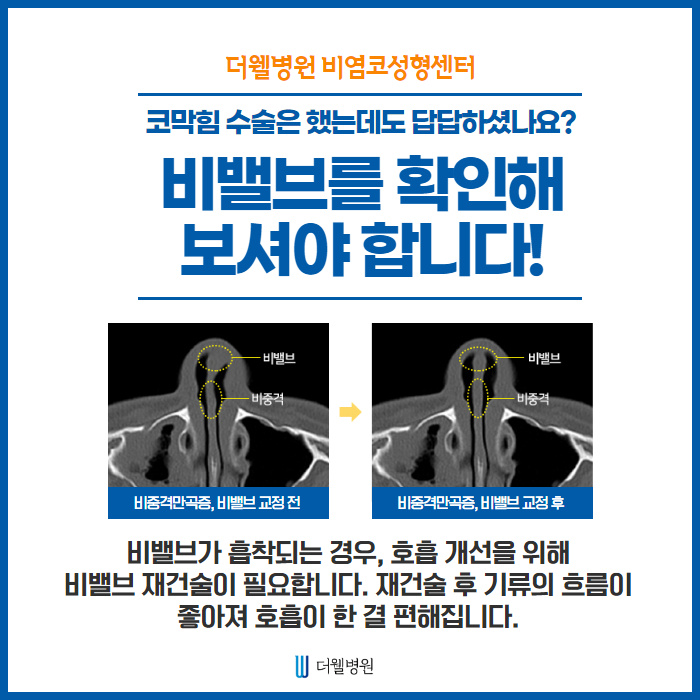 비중격이 휘어지는 이유는?? (6/12)