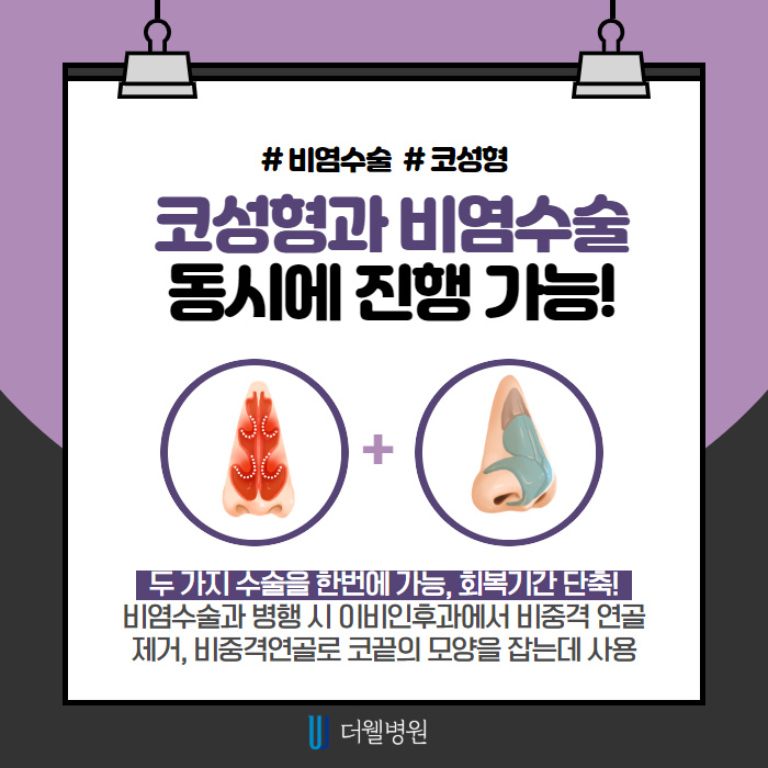 코성형시 기억해야할 점은?! (4/9)