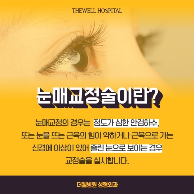 졸리고 처진 눈을 생기있게! (2/11)