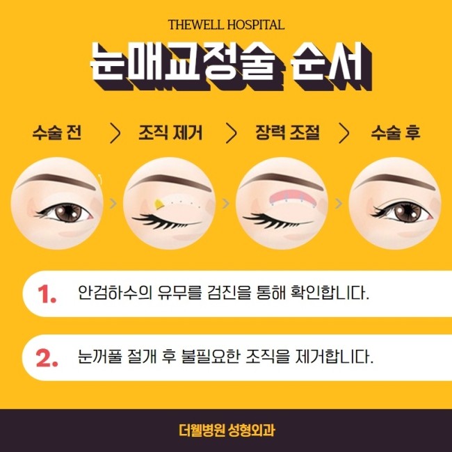 졸리고 처진 눈을 생기있게! (5/11)