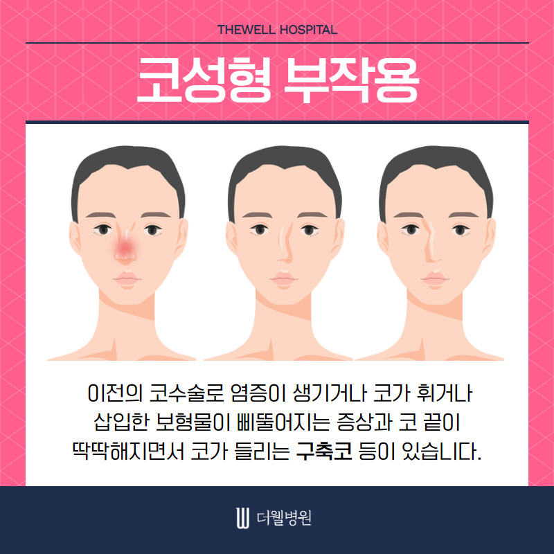 기능과 모양까지 고려해야 성공하는 여성 코재수술 (2/10)