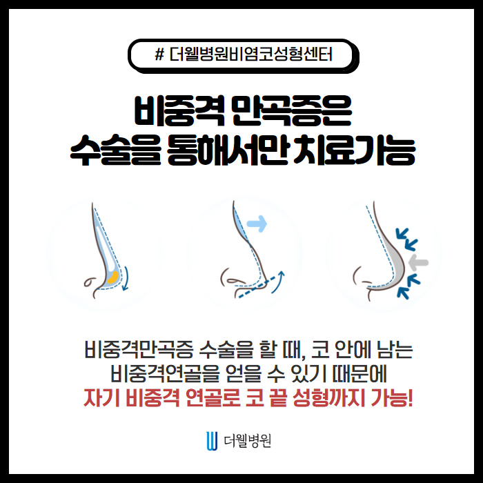 비중격만곡증을 무찌르러 왔다! (5/10)
