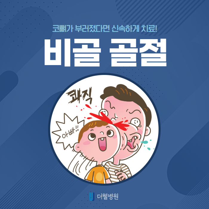 코 뼈가 부러졌다면 신속하게 치료! (1/10)