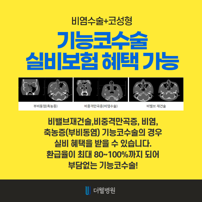 비염수술을 해야하는 이유?! (8/10)