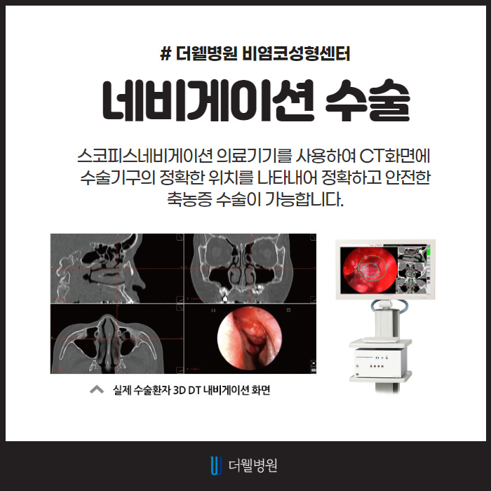 콧물, 코막힘, 축농증! 시원하게 탈출! (5/9)