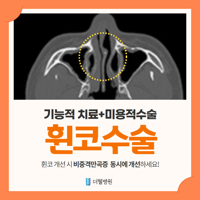 휜 코 개선할 때 비중격만곡증 동시에 개선하세요~ (1/10)