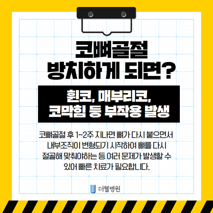 코뼈골절 수술! 휜코, 코막힘 해결! (5/11)