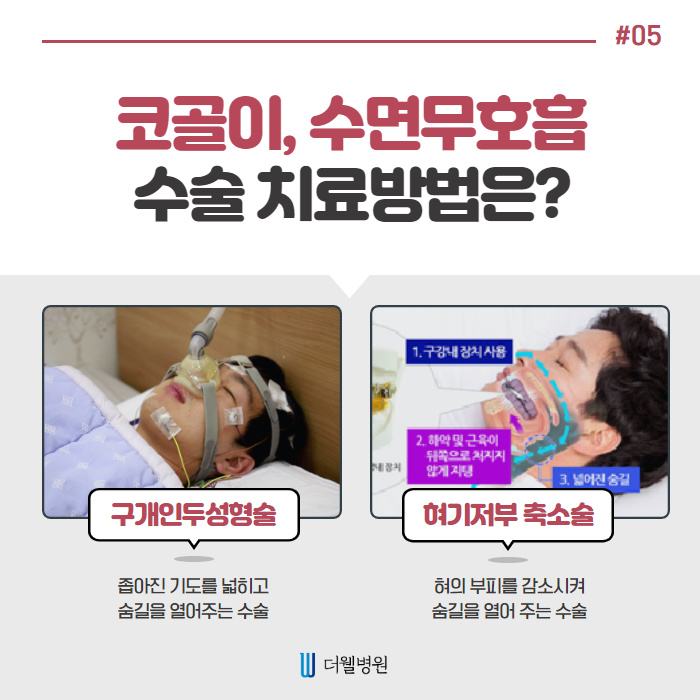 헐; 코골이가 질병이라구? (6/10)