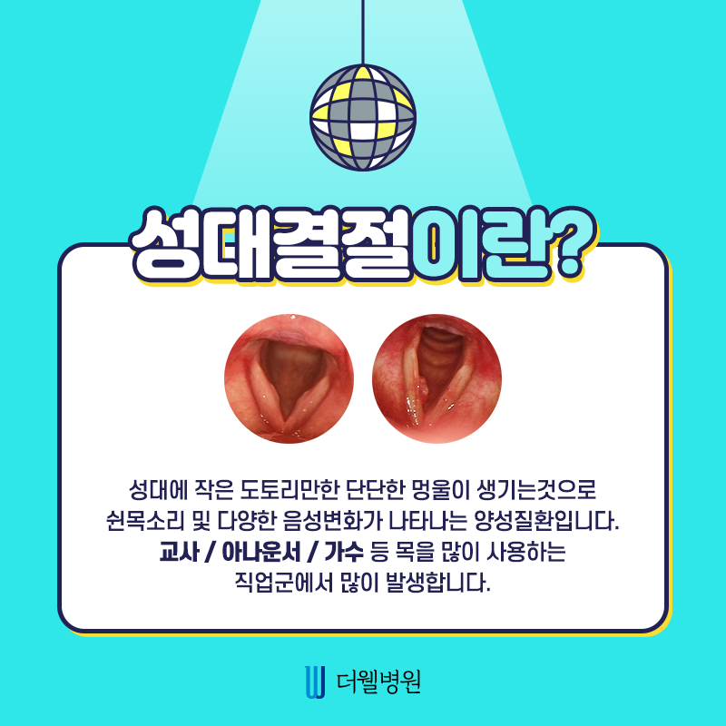 성대결절 원인부터 치료까지! 드루와~ (2/10)