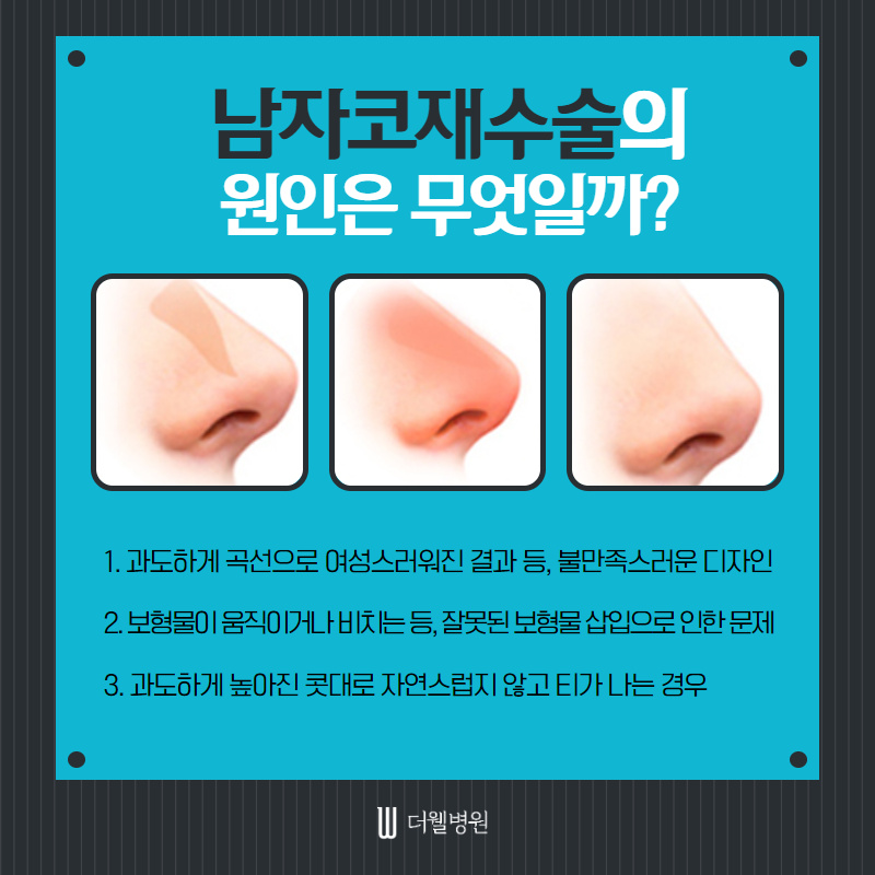 두번의 실패는 없다! 남자코재수술! (3/10)