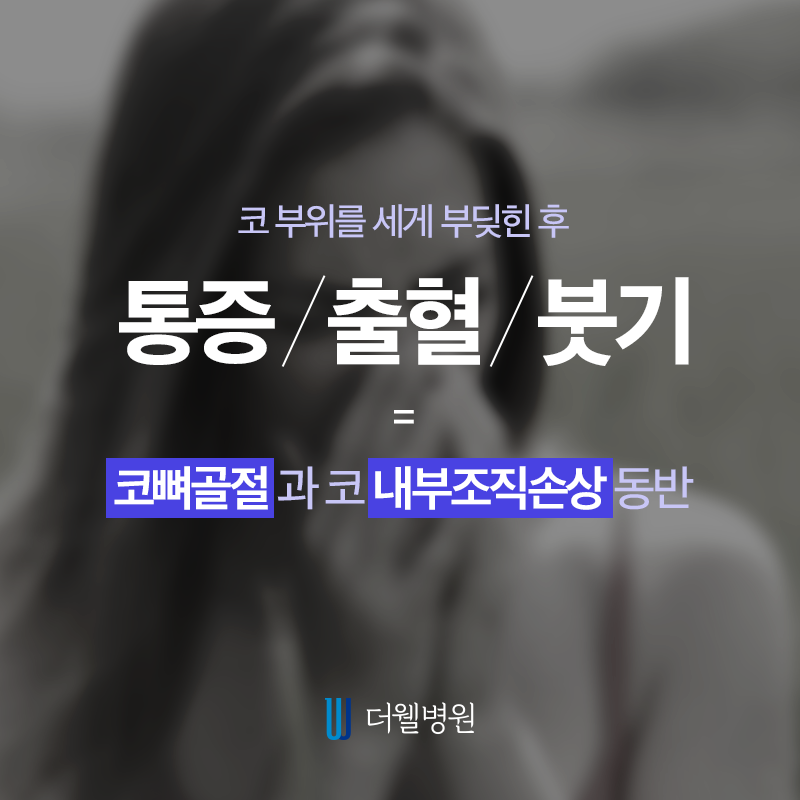 방치하면 위험한 코뼈골절! (2/9)