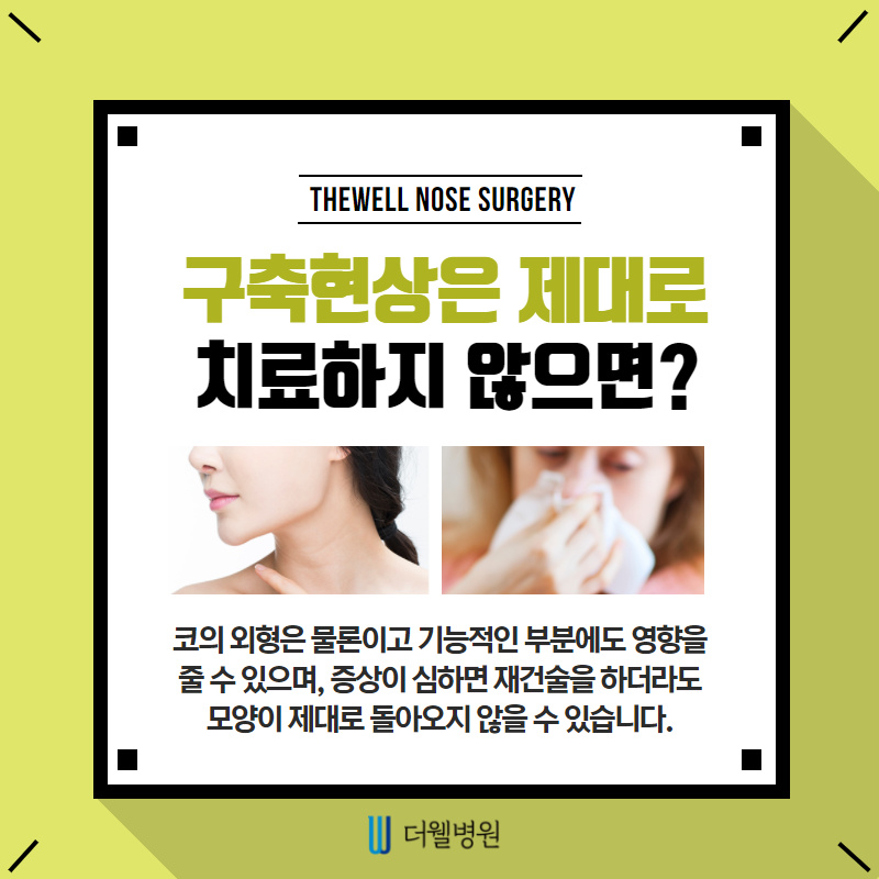 구축코 재수술 주의사항 확인하기! (4/10)