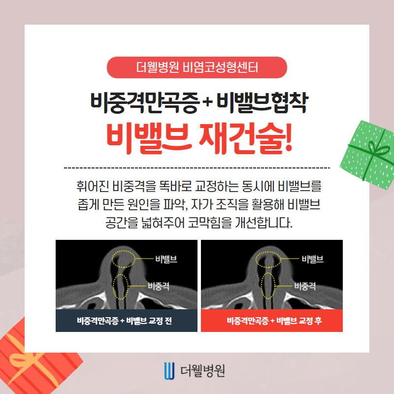 겨울만되면 막히는 코.....만성코막힘의 원인을 알아보자 (6/10)