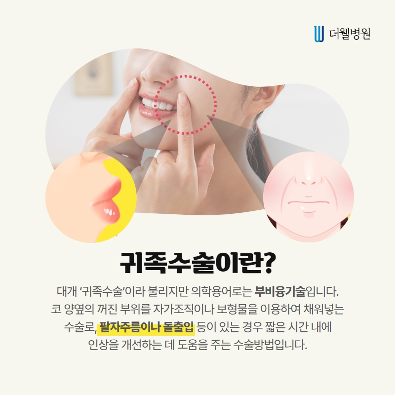 더웰병원 귀족수술