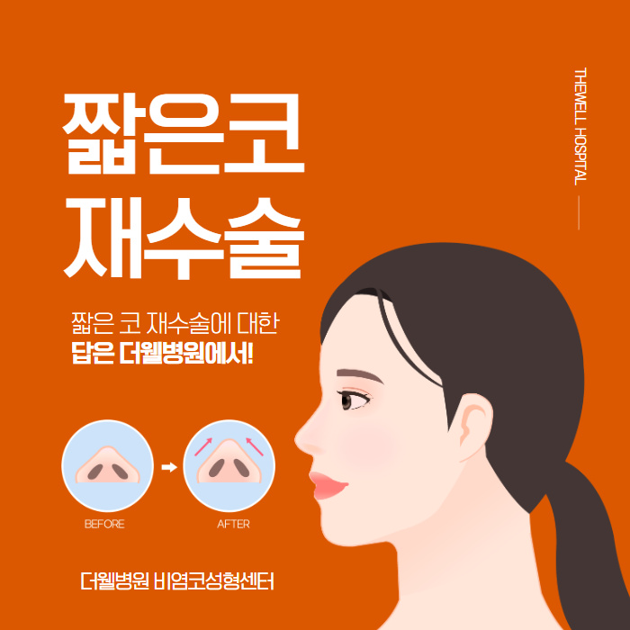 더웰병원 들창코·짧은코 교정