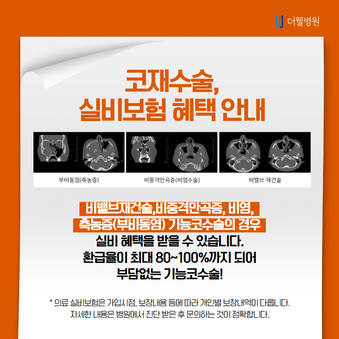 더웰병원 들창코·짧은코 교정